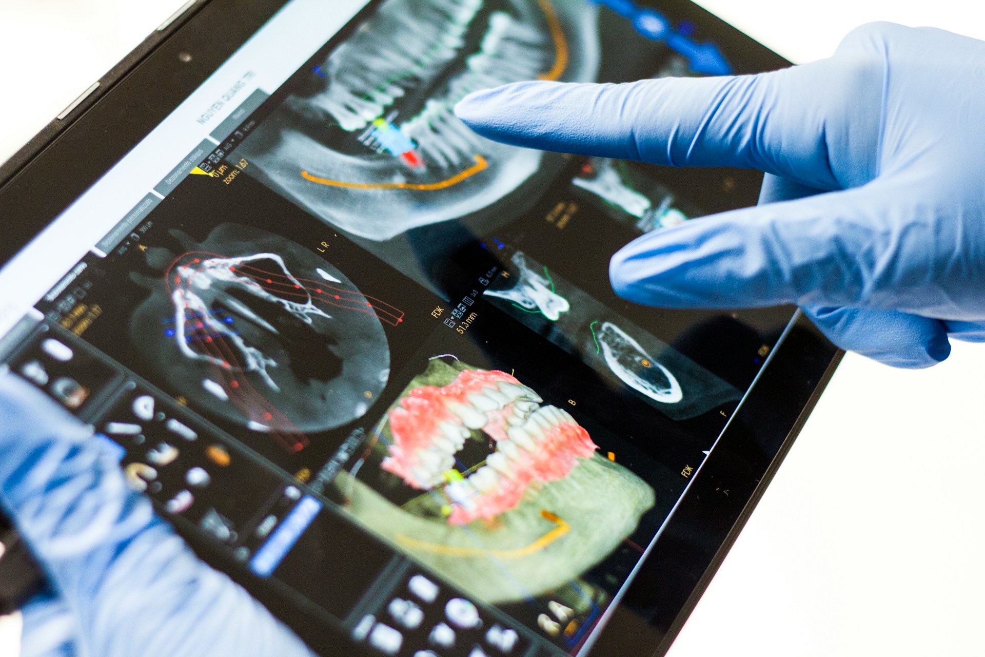Dental Assistant Salary in Canada: Understanding Compensation in 2026 3 PTO and Bonuses