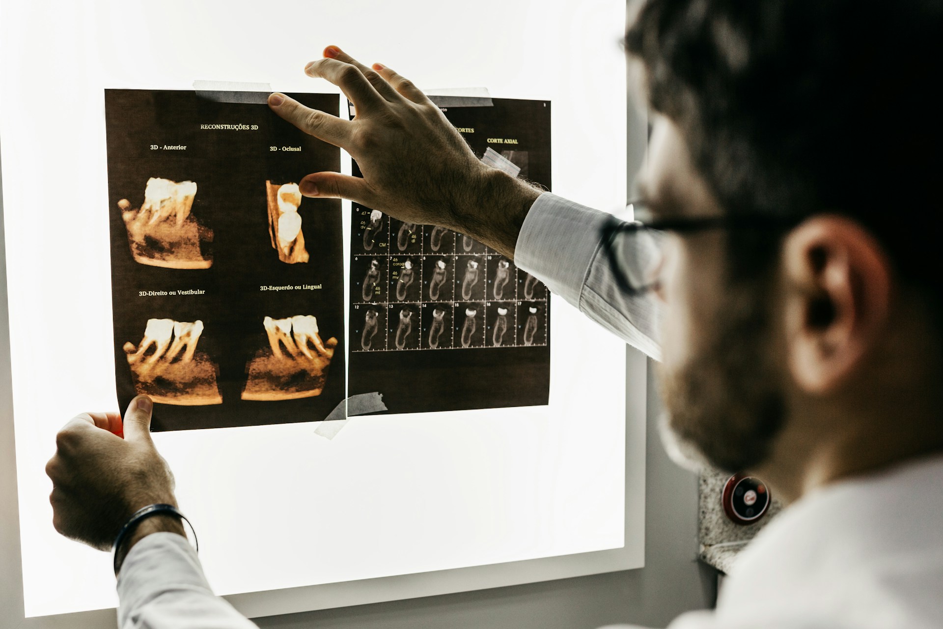 What Does a Dental Assistant Do? Job Overview 3 Taking and Developing Dental X-rays