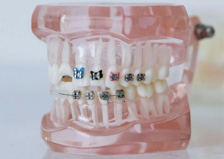 dental equipment