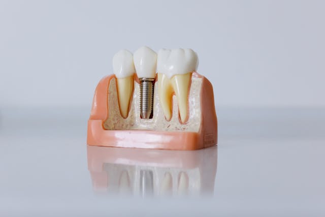 denture on top of a white glass table