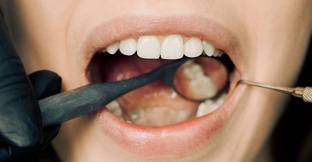 patient having a dental checkup