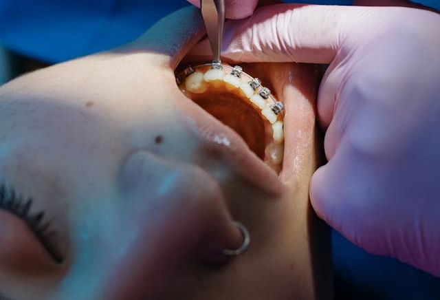 lady having a dental procedure